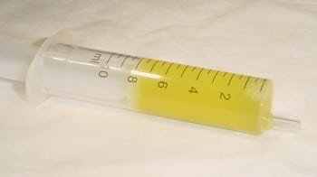 pif chat ponction liquide abdominal coronavirus