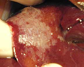 péritonite infectieuse chat pif pyogranulomes foie coronavirus