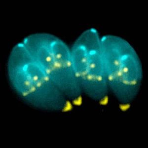 toxoplasmose parasite contamination symptômes traitement