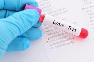 diagnostic-maladie-lyme-chien diagnostic maladie de Lyme chien sérologie PCR