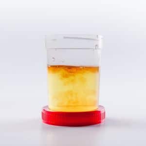 sang dans urine chat