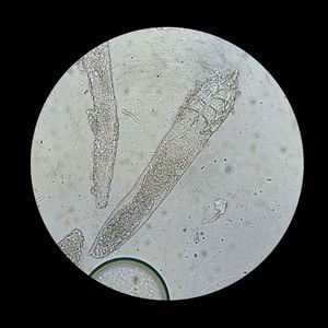 demodex canis démodécie chien
